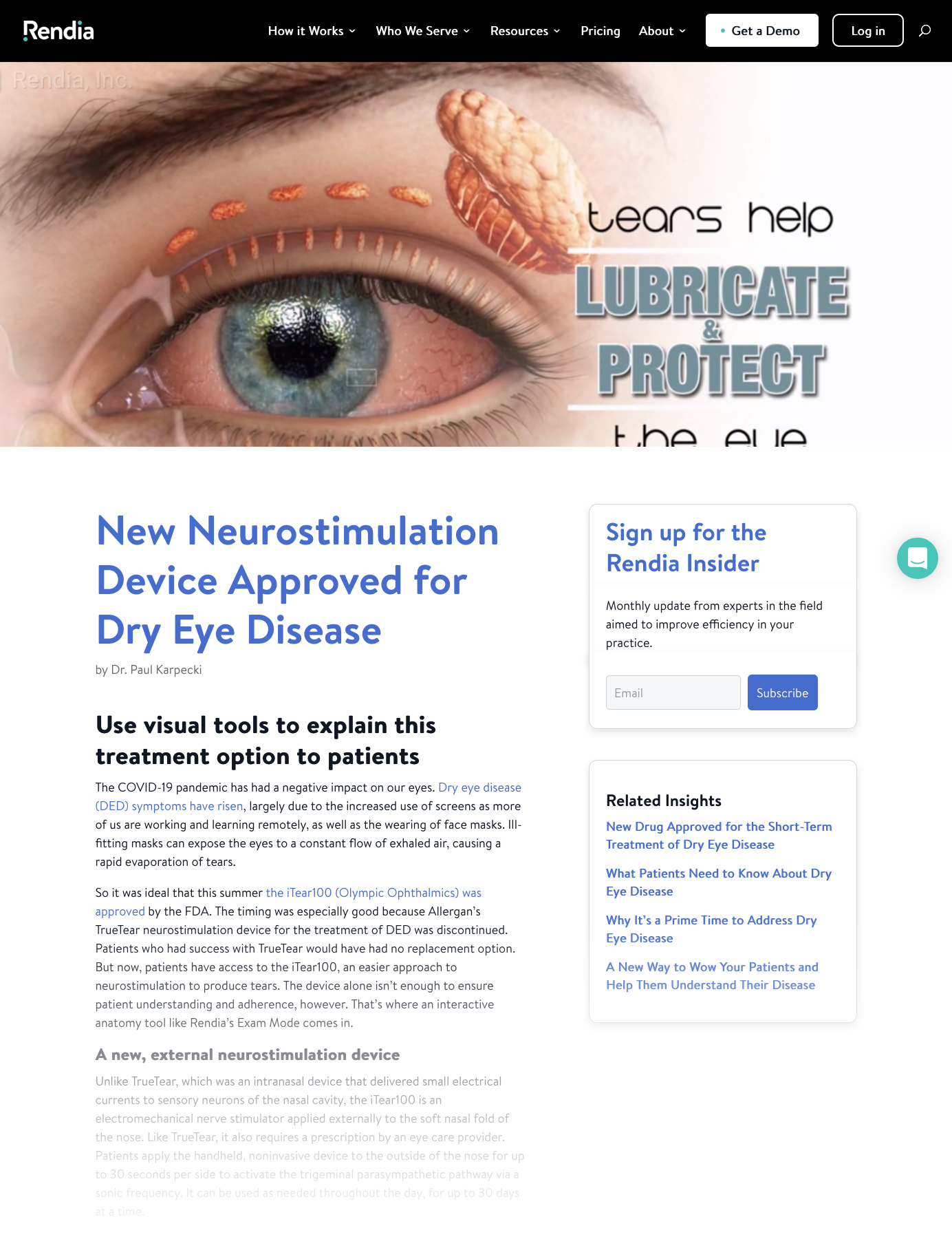 5-Rendia-resources-insights-new-neurostimulation-device-june3-2020